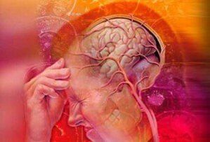 Hypertension contre l'ostéochondrose